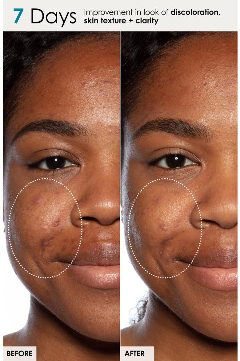 Jumbo Good Genes Face Treatment $284 Value, Alternate, color, NO COLOR