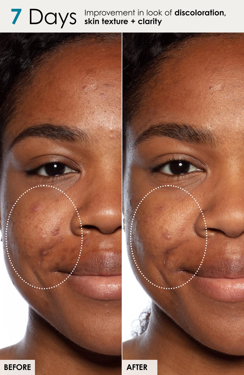 Sunday Riley Jumbo Good Genes Face Treatment $284 Value, Alternate, color, 