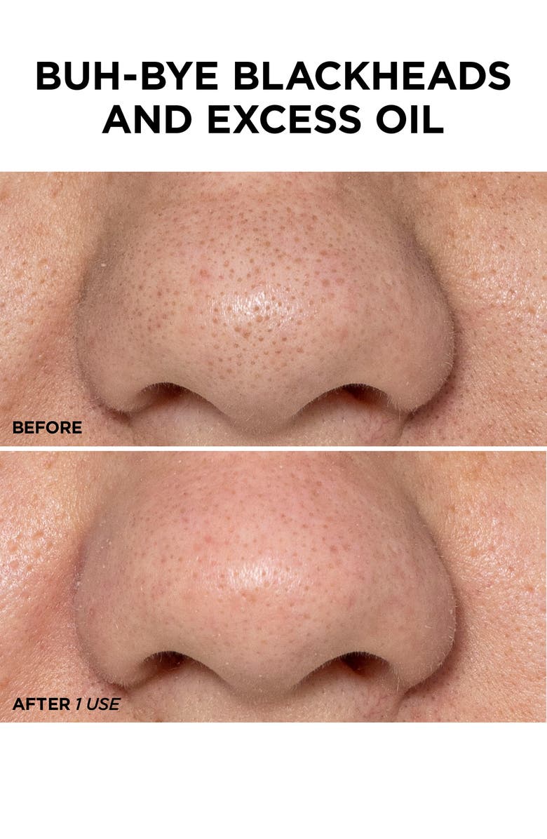 BeautyBio x Christian Siriano GLOfacial Hydro-Infusion Pore Cleansing Tool, Alternate, color, 