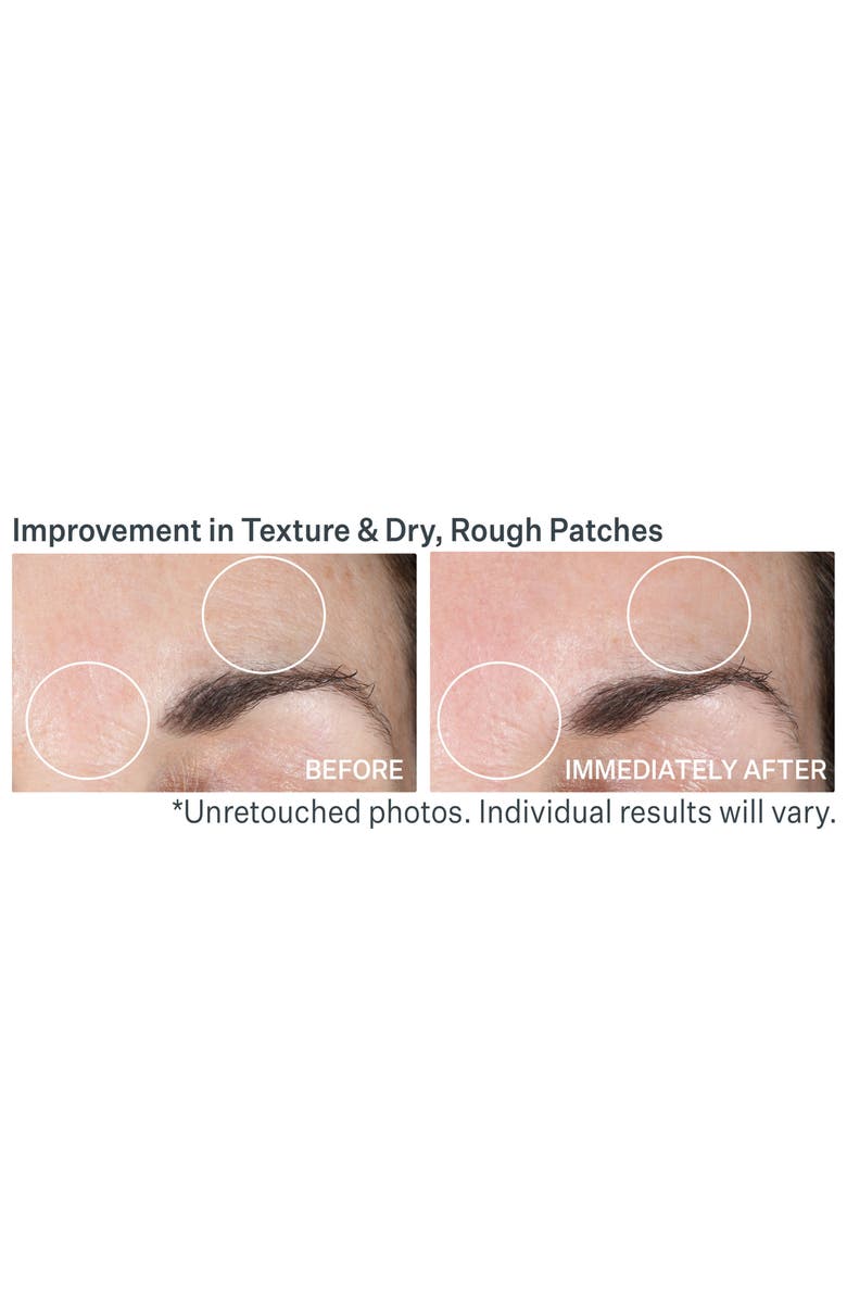 StriVectin<sup>®</sup> Advanced Resurfacing Pro Glowfoliant<sup>™</sup> Mix-In Microderm Crystals, Alternate, color, 