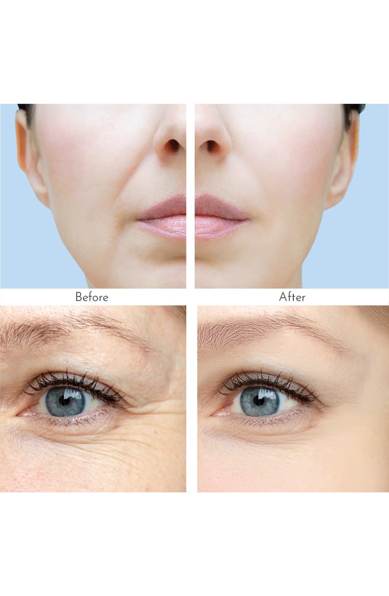 TRULY CLEAR Wrinkle Patches 4 Patches, Alternate, color, 