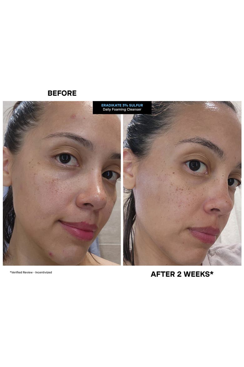 EradiKate® Daily Foaming Cleanser, Alternate, color, NO COLOR