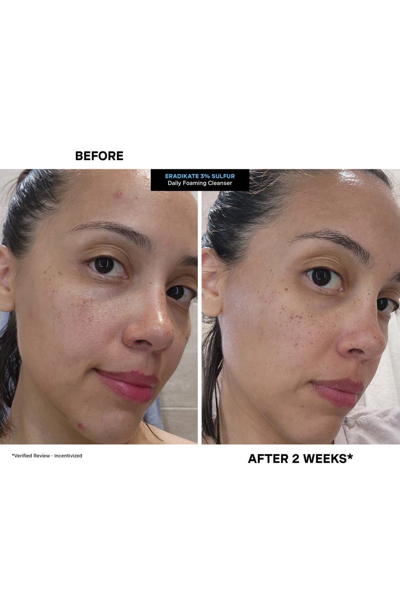 Kate Somerville<sup>®</sup> EradiKate<sup>®</sup> Daily Foaming Cleanser, Alternate, color, 