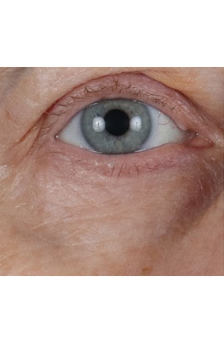 Perricone MD Vitamin C Ester CCC + Ferulic Brightening Under-Eye Cream, Alternate, color, 