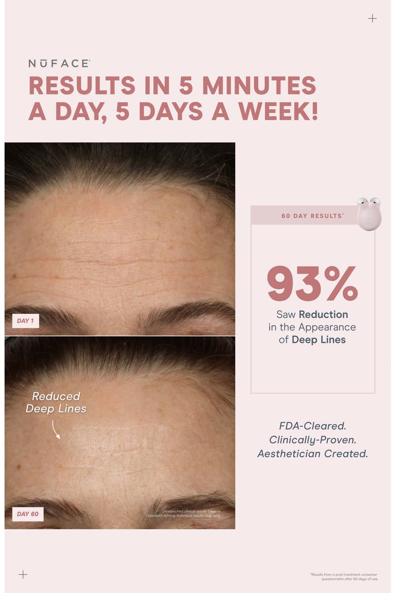 MINI+ Smart On-the-Go Facial Toning Starter Kit $250 Value, Alternate, color, SANDY ROSE