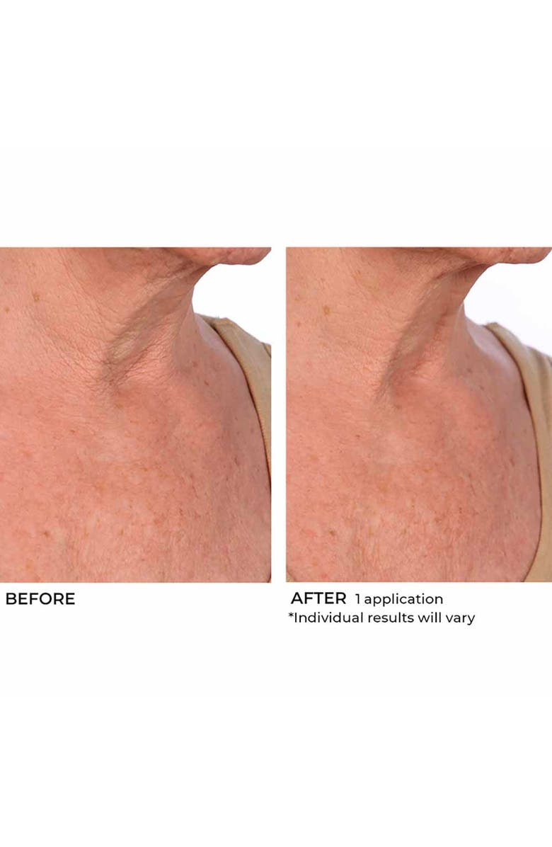 Dr. Nassif Skincare Hydro-Screen Souffle in Various Sizes, Alternate, color, NO COLOR