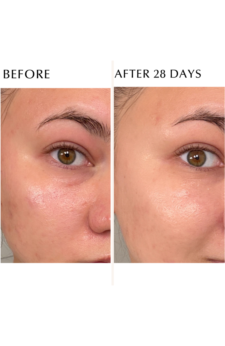 ALBION EXCIA Brightening Immaculate Serum, Alternate, color, 1.5Ml X 28