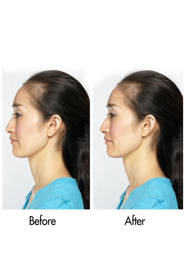Follicle Boosting Serum, Alternate, color, NO COLOR