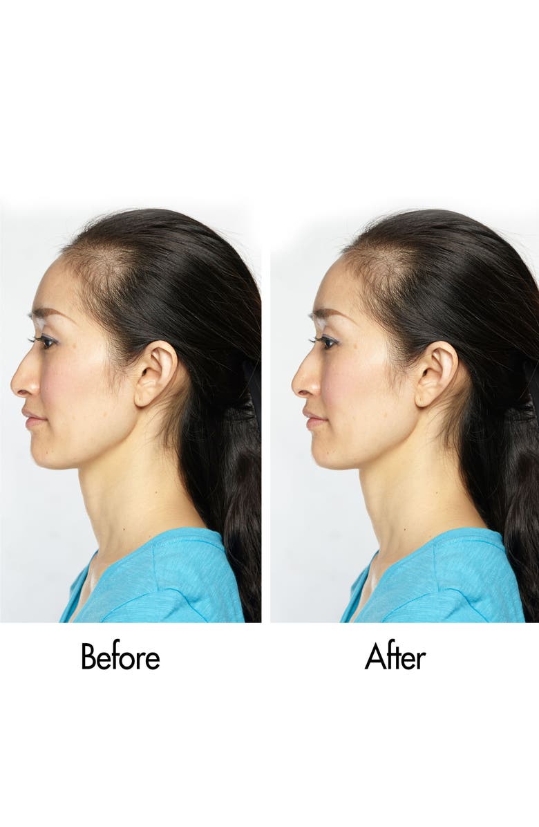 Keranique Follicle Boosting Serum, Alternate, color,