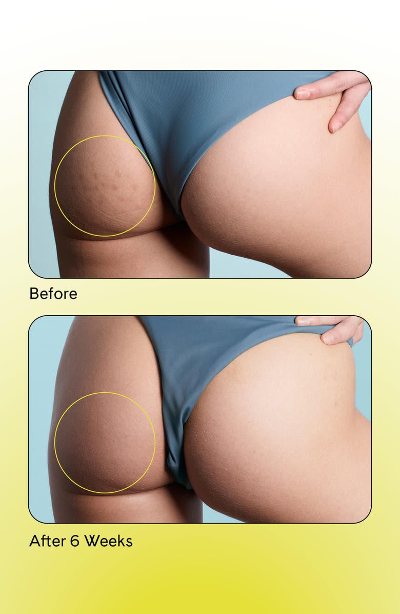 Fur Skincare Dark Spot Vanish Patch, Alternate, color, 