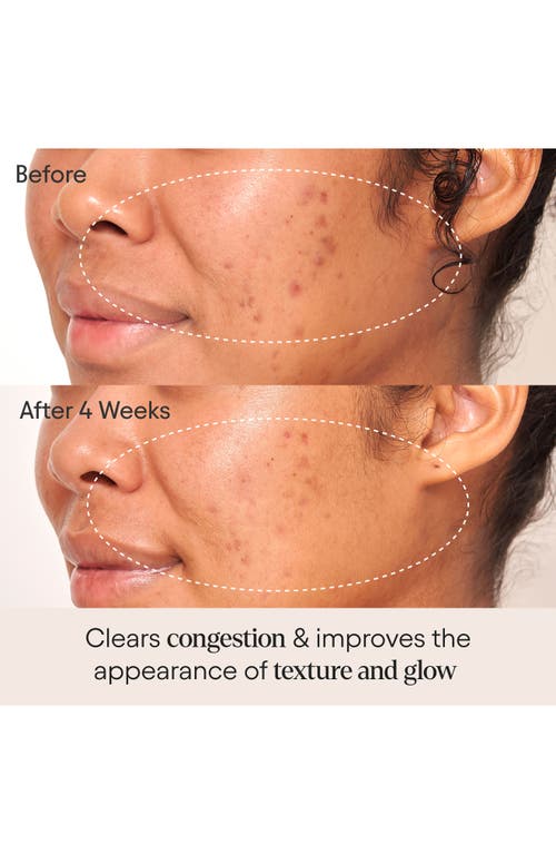 Alpyn Clarifying Facial Oil In No Color