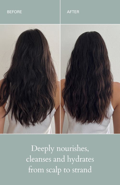 Roz Healthy Hair & Scalp Kit In Transparent