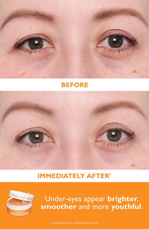 Peter Thomas Roth Vitamin C & Hyaluronic Eye Patches 2-piece Kit $120 Value In Transparent