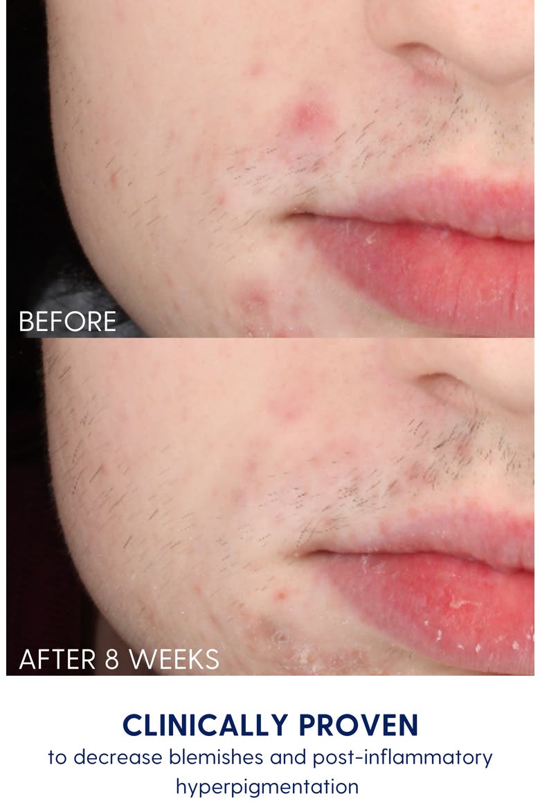 Calm + Bright Face Mask, Alternate, color, None