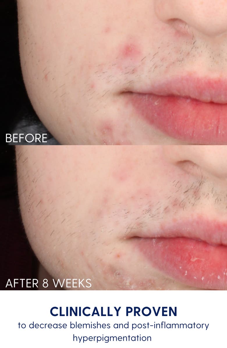 Bright Girl Calm + Bright Face Mask, Alternate, color, NO COLOR