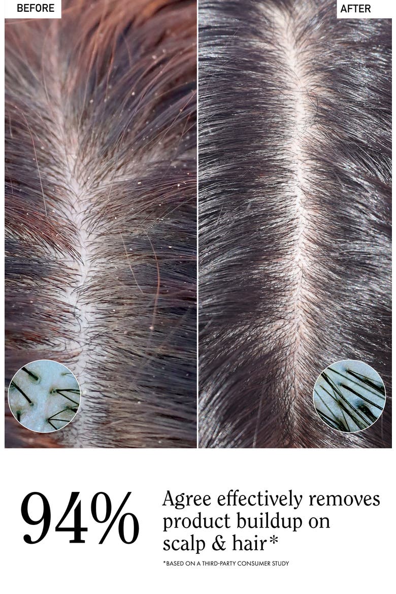 Apple Cider Vinegar Scalp & Hair Rinse, Alternate, color, NONE