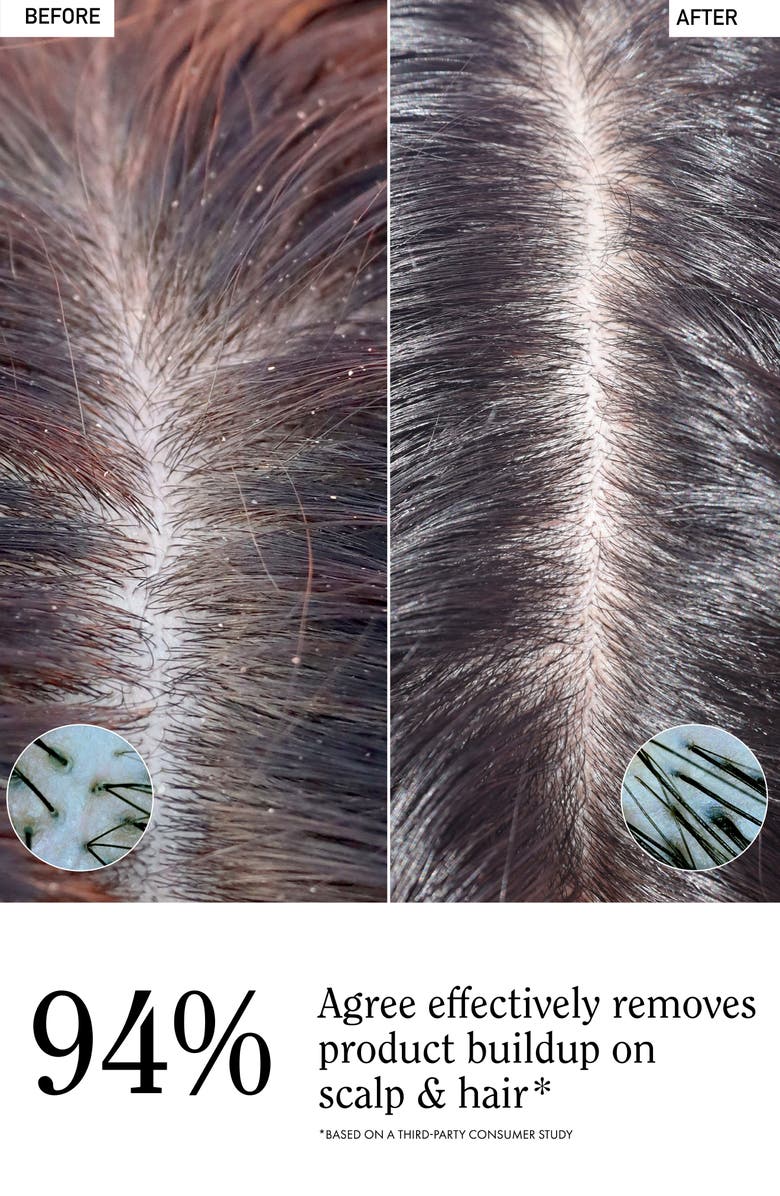 RIZOS CURLS Apple Cider Vinegar Scalp & Hair Rinse, Alternate, color,