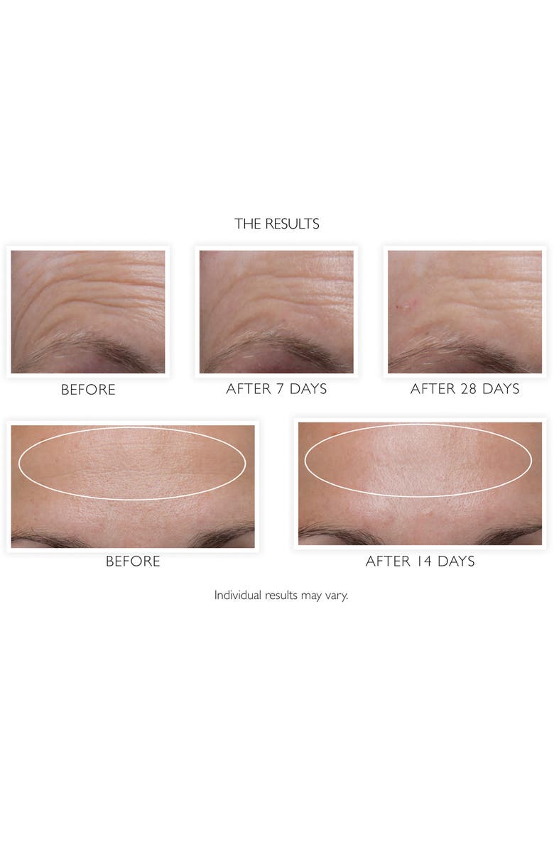 Peter Thomas Roth Hungarian Thermal Water Mineral-Rich Moisturizer, Alternate, color,