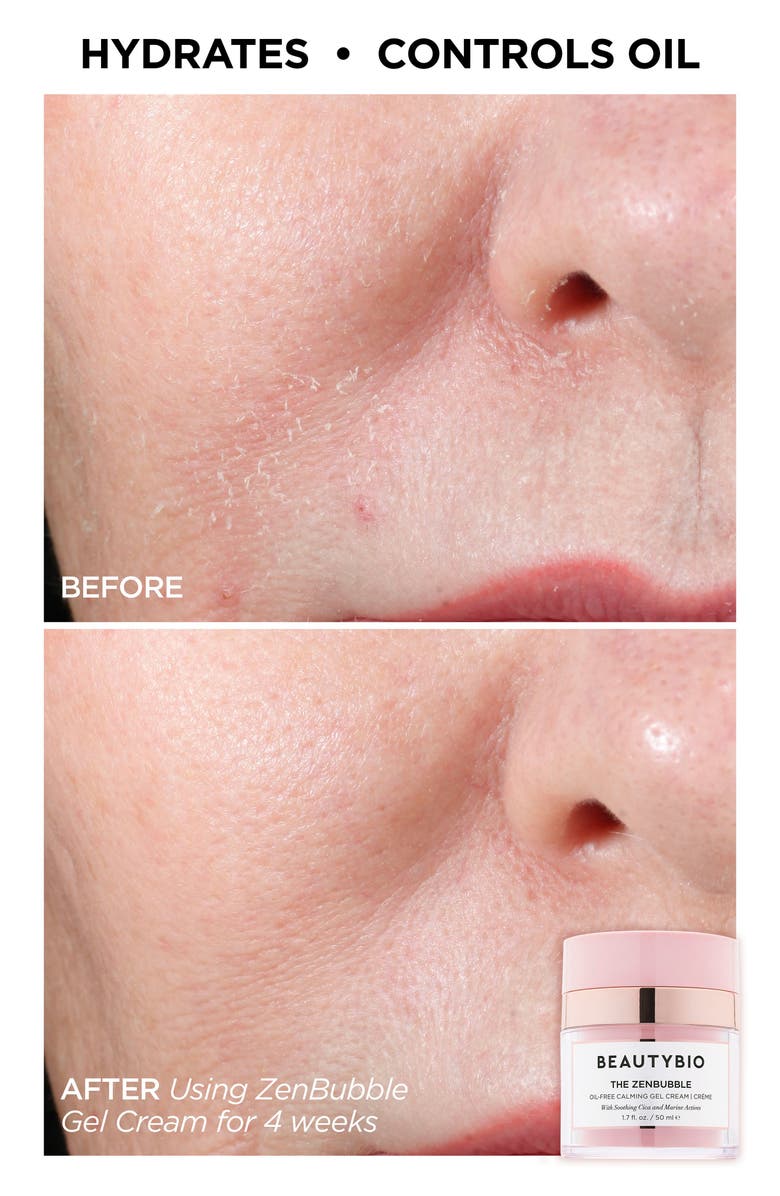 BeautyBio Head to Toe AfterGLO GloPRO<sup>®</sup> Set (Limited Edition) (Nordstrom Exclusive) $317 Value, Alternate, color,