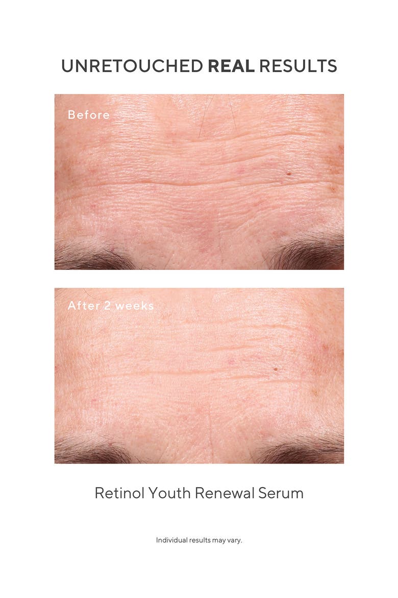 Under the Microscope: The Retinol Renewers Set (Limited Edition) $164 Value, Alternate, color, NO COLOR