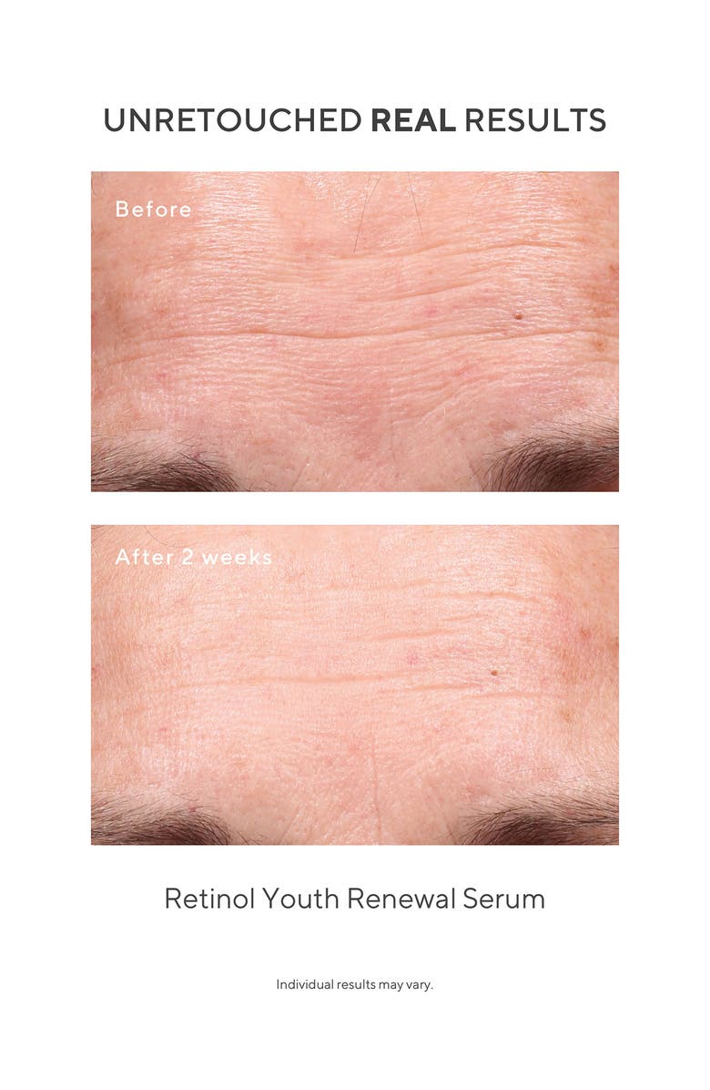 Murad<sup>®</sup> Under the Microscope: The Retinol Renewers Set (Limited Edition) $164 Value, Alternate, color,