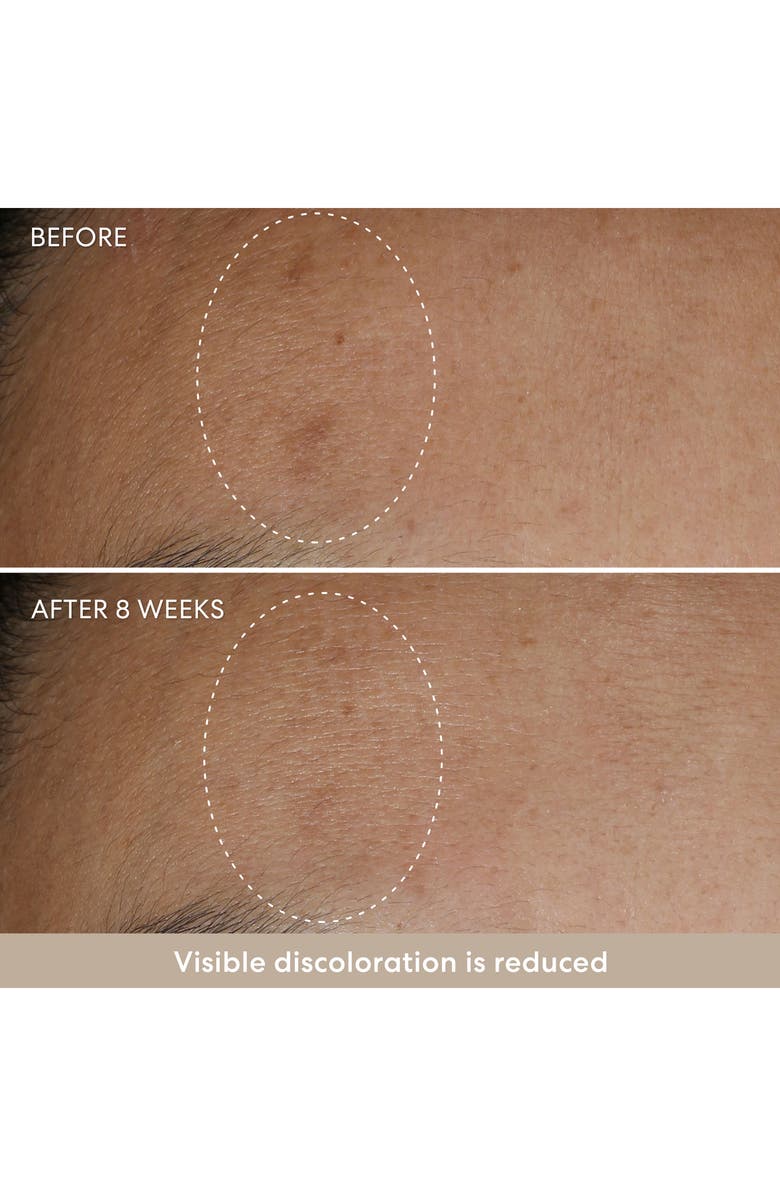 bareMinerals<sup>®</sup> Stronger Skin Starter Set, Alternate, color, 