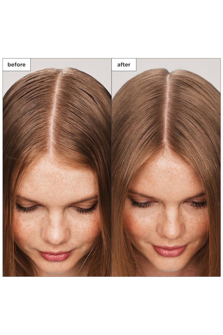Scalp Revival™ Charcoal + Tea Tree Scalp Treatment Serum, Alternate, color, NO COLOR