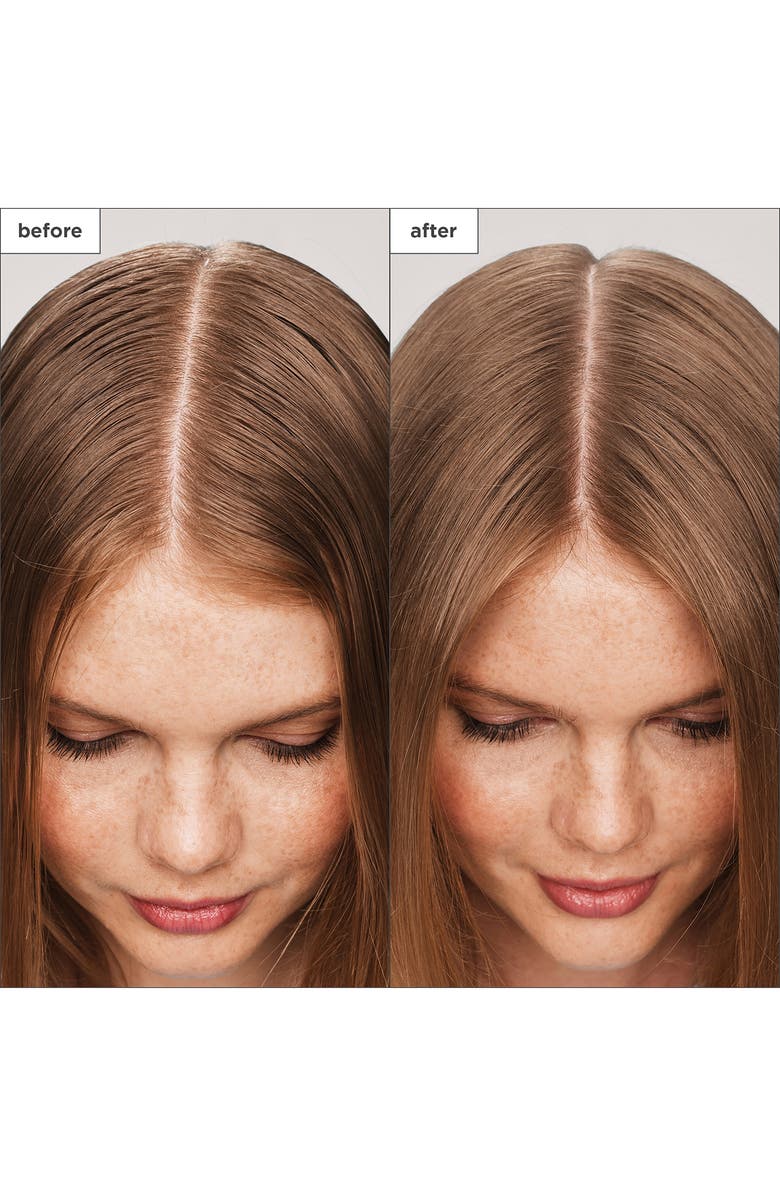 Briogeo Scalp Revival<sup>™</sup> Charcoal + Tea Tree Scalp Treatment Serum, Alternate, color,