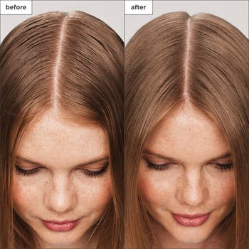 Scalp Revival<sup>™</sup> Charcoal + Tea Tree Scalp Treatment Serum