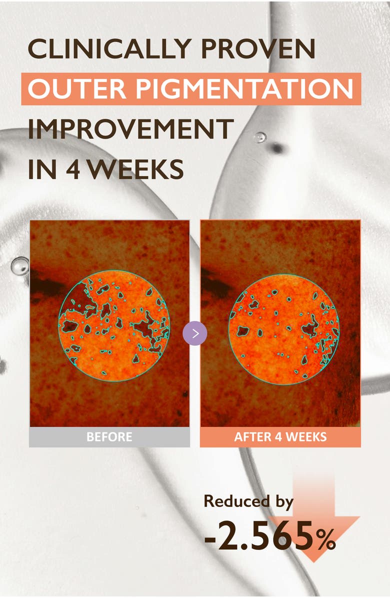 haruharu wonder Centella 4% TXA Dark Spot Go Away Serum, Alternate, color, NO COLOR