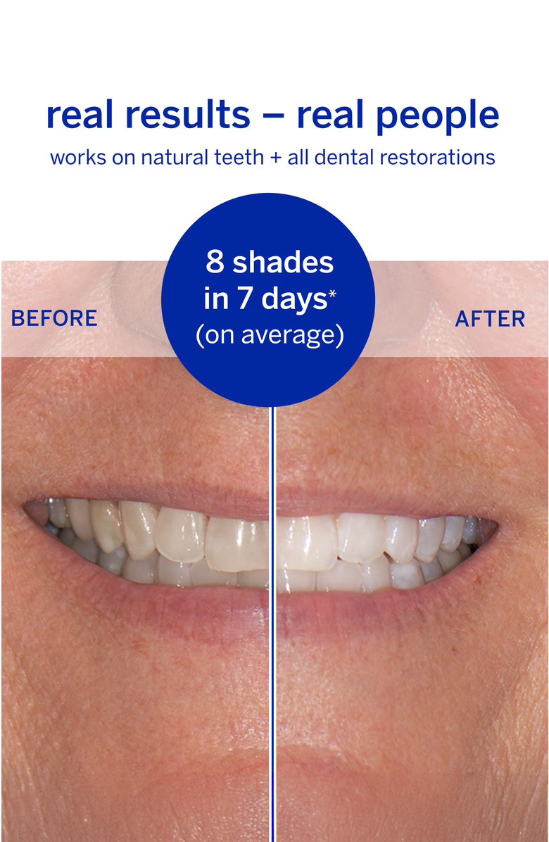 Supersmile Superstrips Dissolving Strips Box Of 14, Alternate, color, White