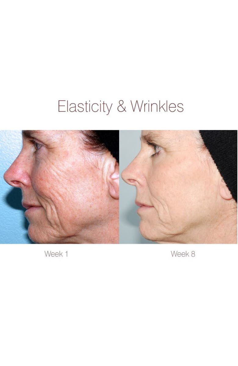 PMD Personal Microderm Device, Alternate, color,