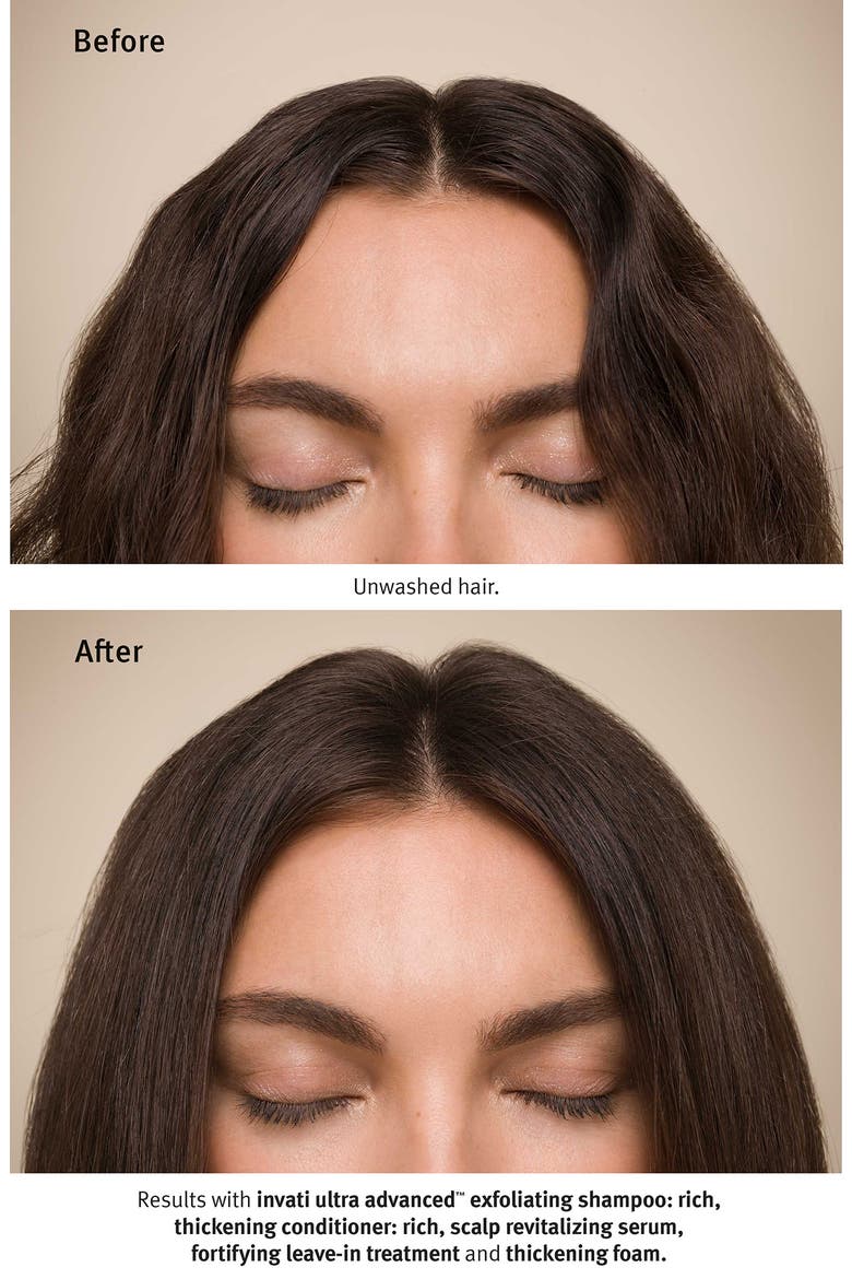 invati ultra advanced™ Rich Hair Care System Set $205 Value, Alternate, color, RICH