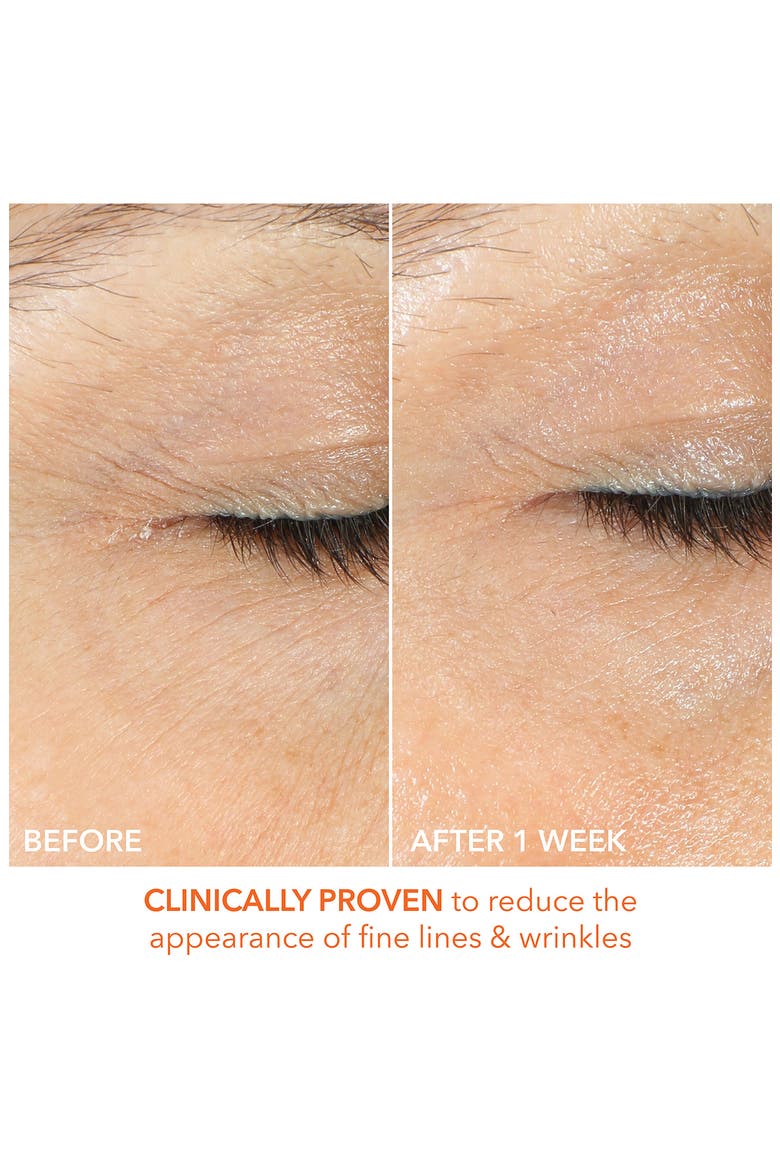 Vitamin C Lactic Firm & Bright Eye Treatment, Alternate, color, NO COLOR