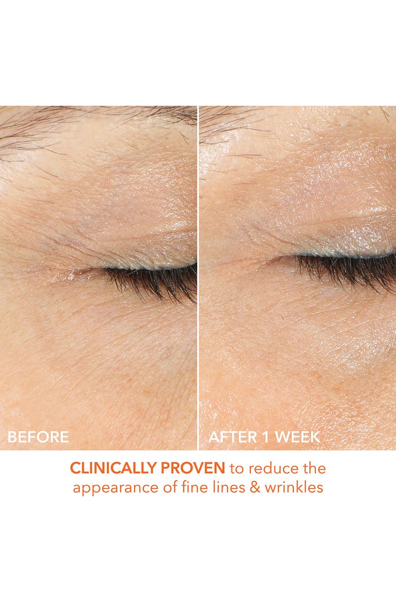 Dr. Dennis Gross Skincare Vitamin C Lactic Firm & Bright Eye Treatment, Alternate, color, 