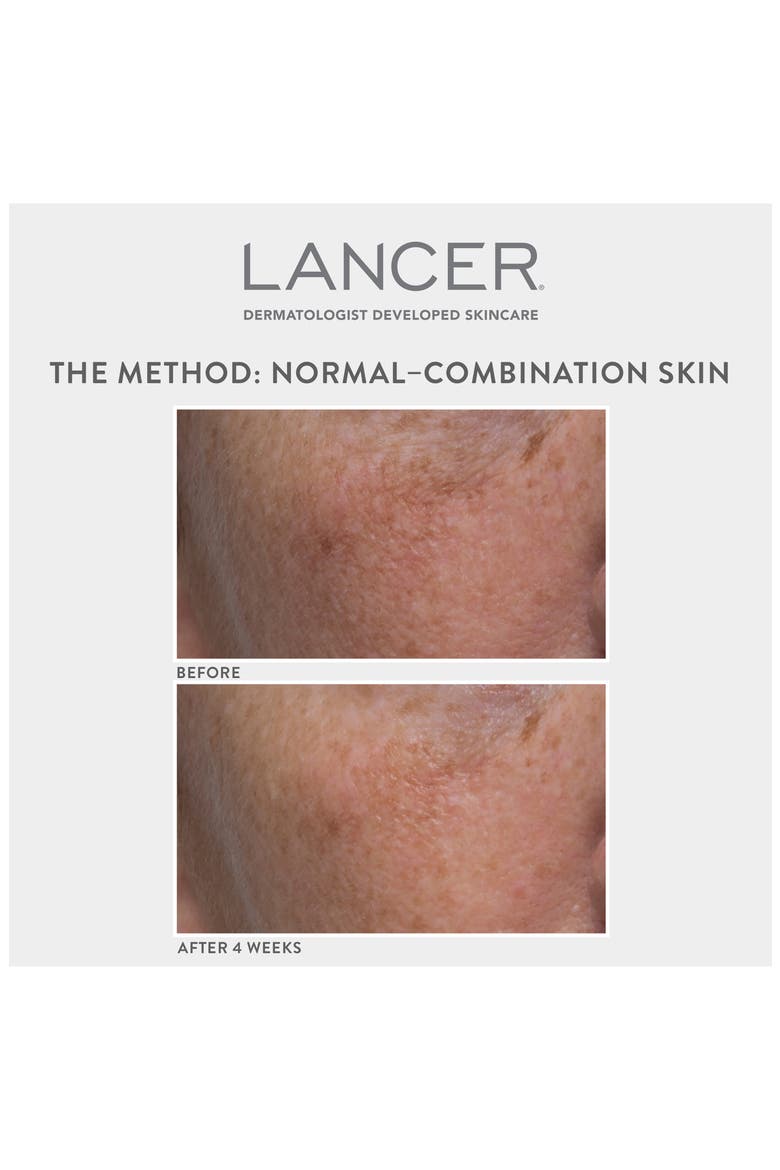 Lancer Method Set $270 Value, Alternate, color, NO COLOR