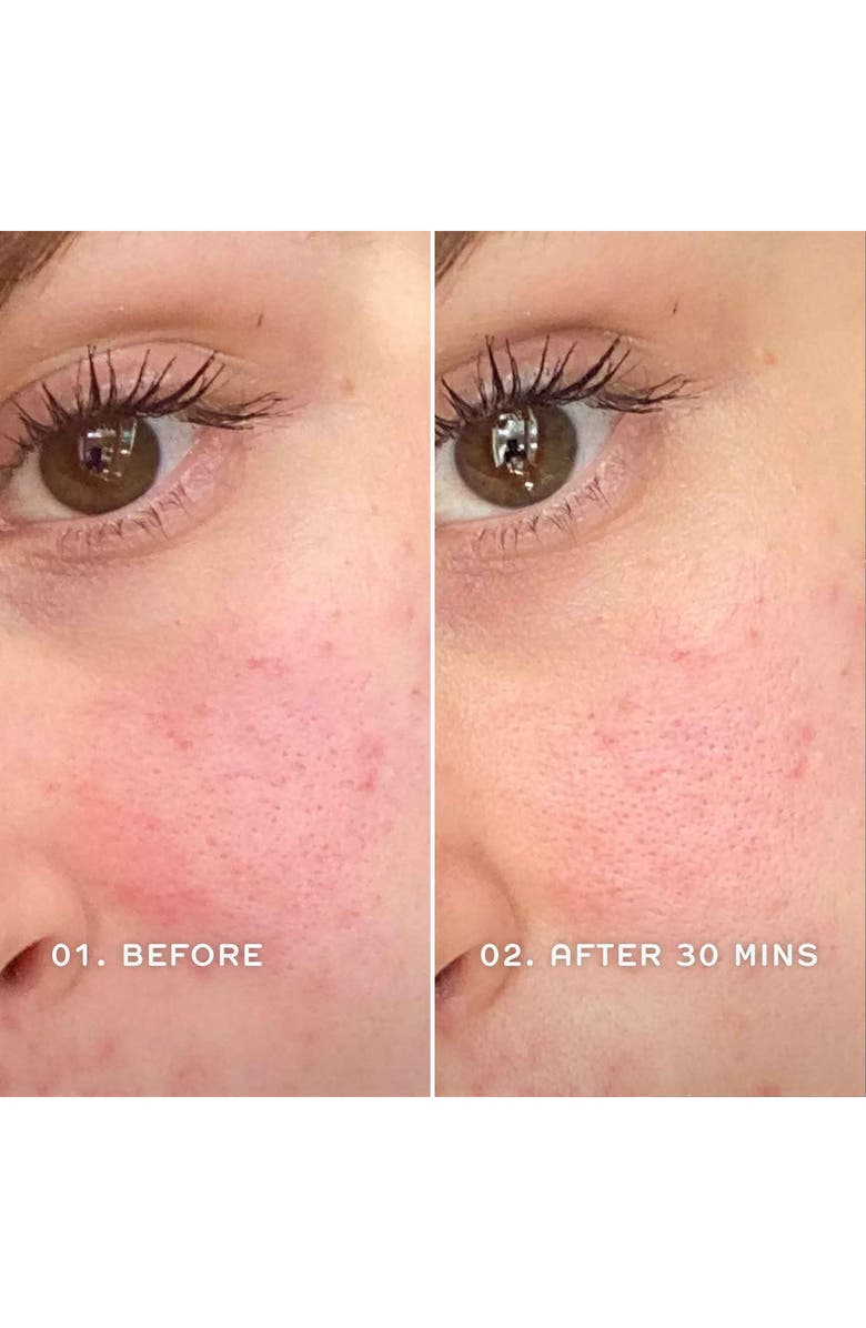 REN Clean Skincare Evercalm<sup>™</sup> Redness Relief Serum, Alternate, color, 