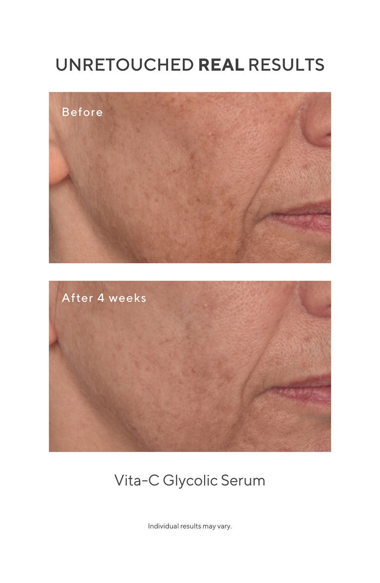 Murad<sup>®</sup> Under the Microscope: The Glow Infusers Set $42 Value, Alternate, color, 