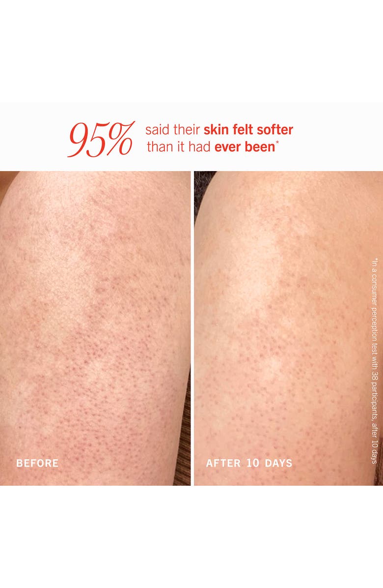 First Aid Beauty KP Bump Eraser Body Scrub with 10% AHA Fresh Peach, Alternate, color, 