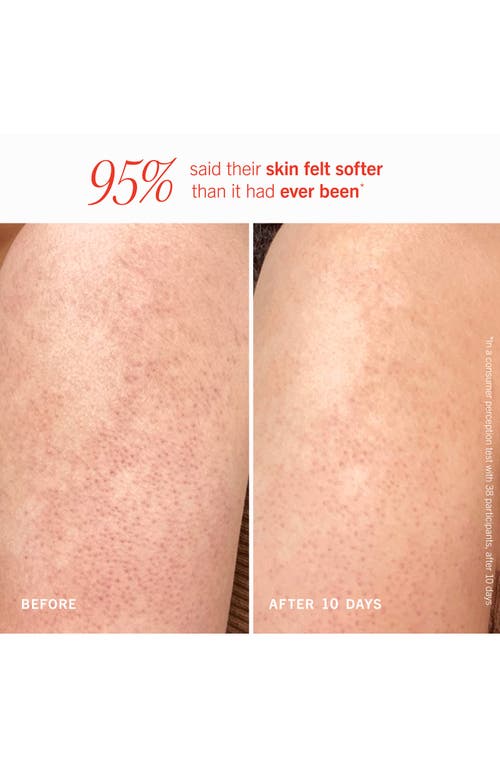 First Aid Beauty Kp Bump Eraser Body Scrub With 10% Aha Fresh Peach