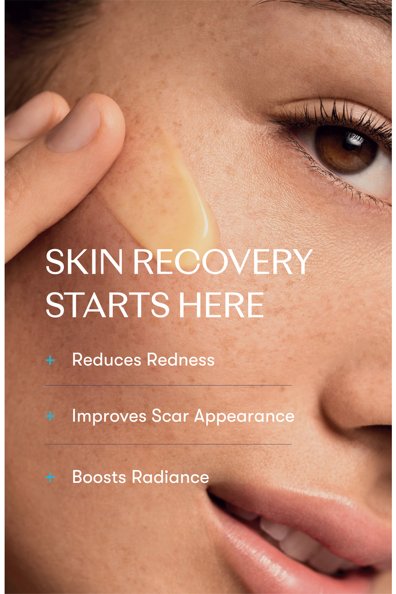 DNA Repair Complex for Redness & Scars, Alternate, color, None