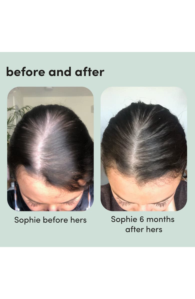 HIMS & HERS Topical Minoxidil Foam 5% Extra Strength Hair Regrowth Treatment, Clinically Proven, Alternate, color, Blue-Green