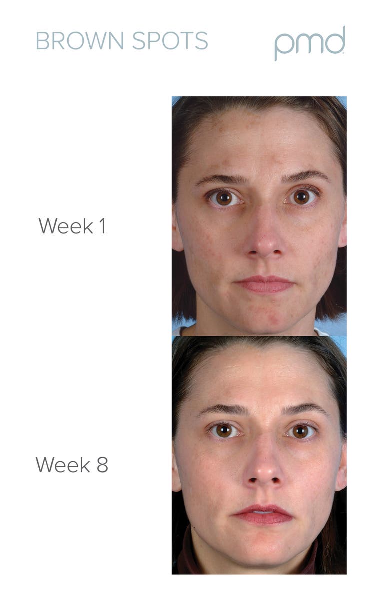 PMD Man Personal Microderm Device, Alternate, color, 