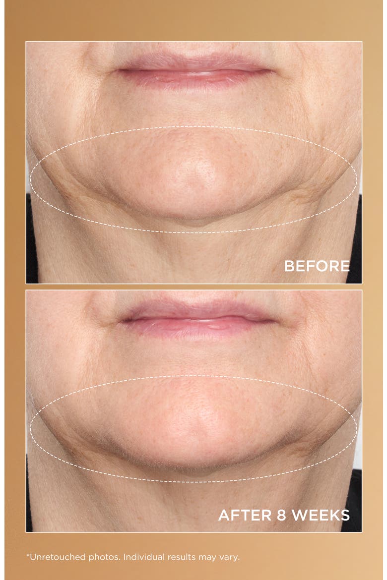 Neuropeptide Deep Crease Serum, Alternate, color, NO COLOR
