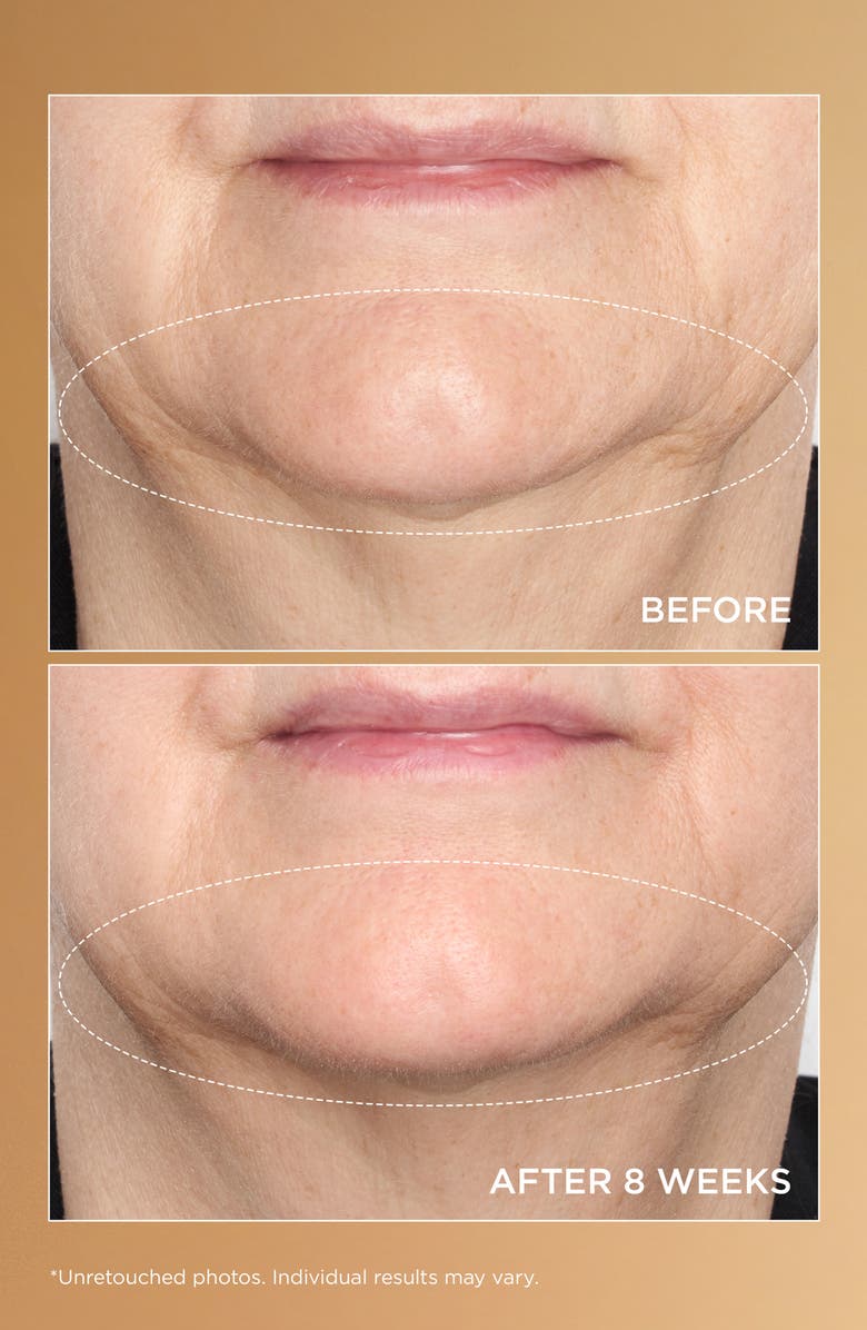 Perricone MD Neuropeptide Deep Crease Serum, Alternate, color, 