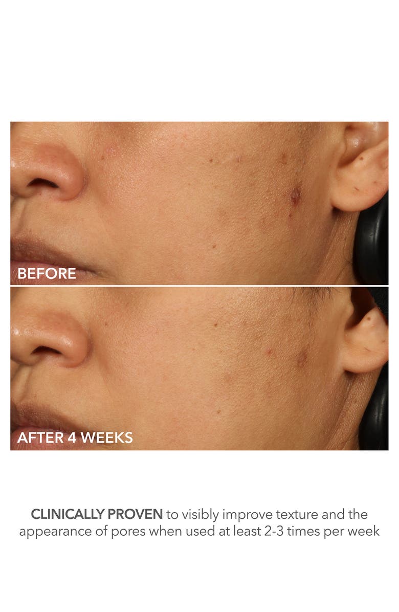 Dr. Dennis Gross Skincare Advanced Retinol + Ferulic Perfectly Dosed Extra Strength 0.5% Treatment Pads, Alternate, color, 