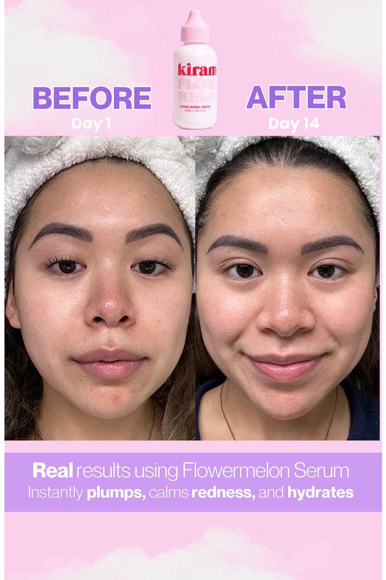 Flowermelon Super Hydra Serum, Alternate, color, PINK