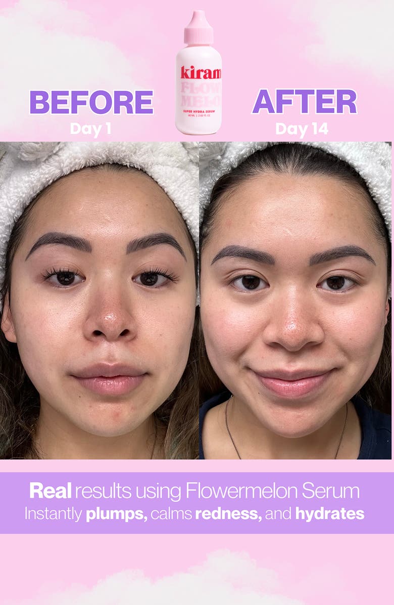 Kiramoon Flowermelon Super Hydra Serum, Alternate, color, Pink