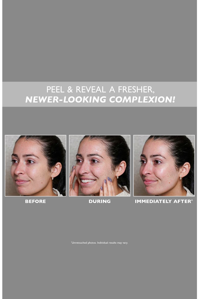 FIRMx® Peeling Gel, Alternate, color, NO COLOR