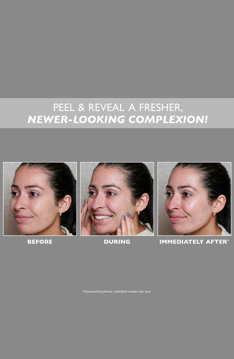 Peter Thomas Roth FIRMx Peeling Gel, Alternate, color,